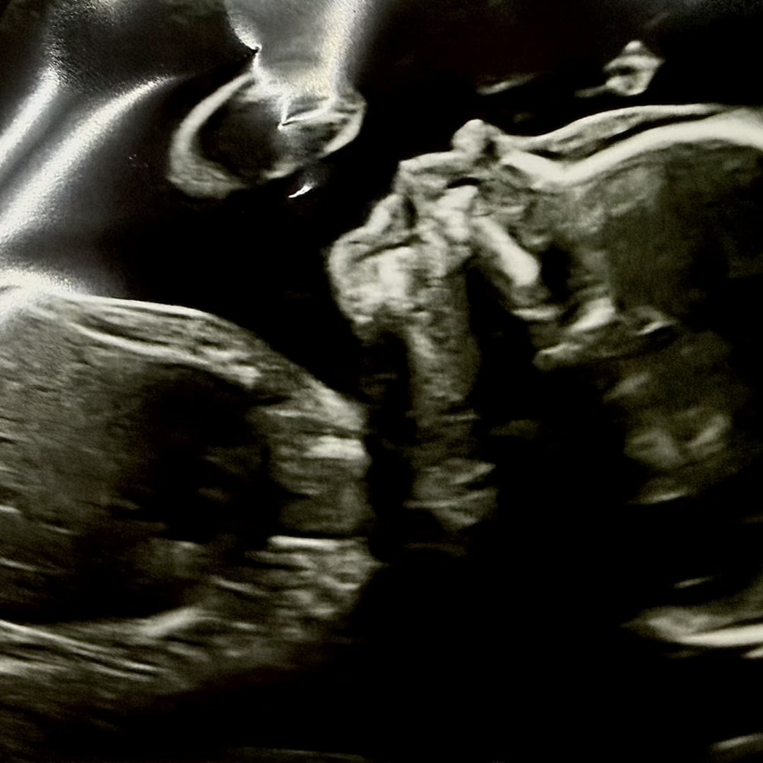 Photo shared by Leah for their Babylist baby registry.