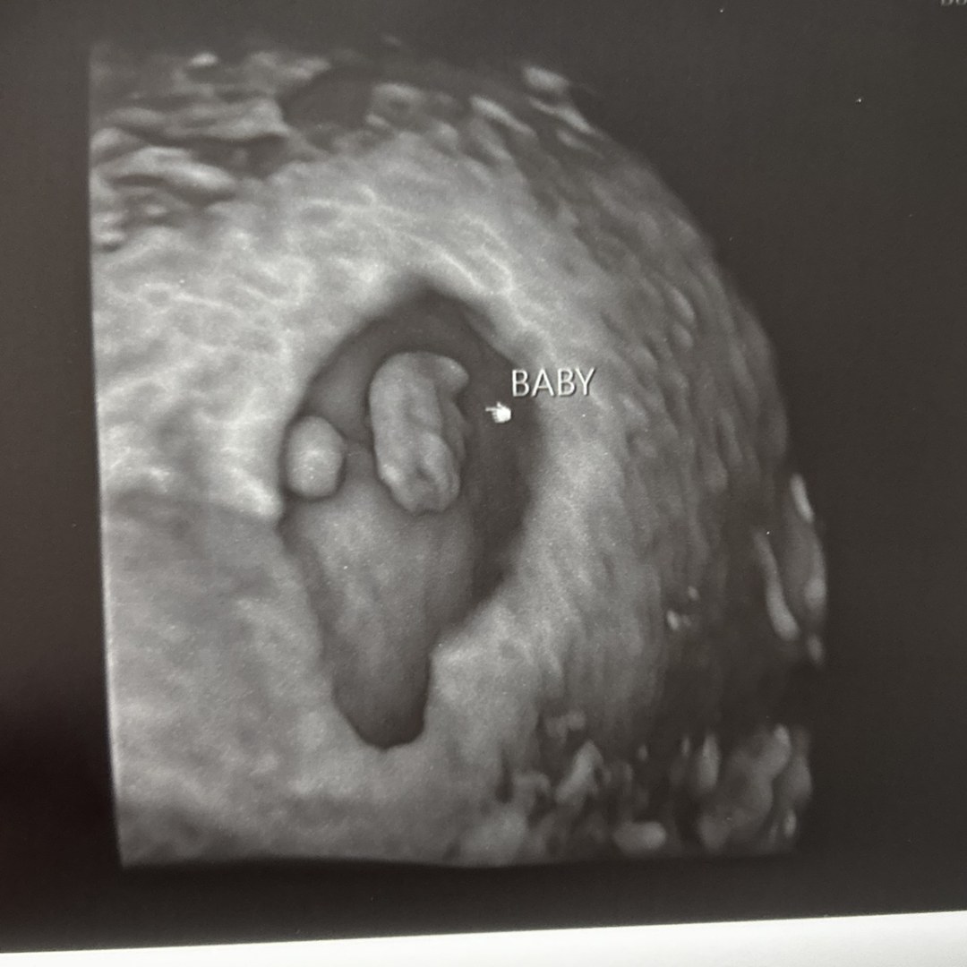 Photo shared by Echo for their Babylist baby registry.