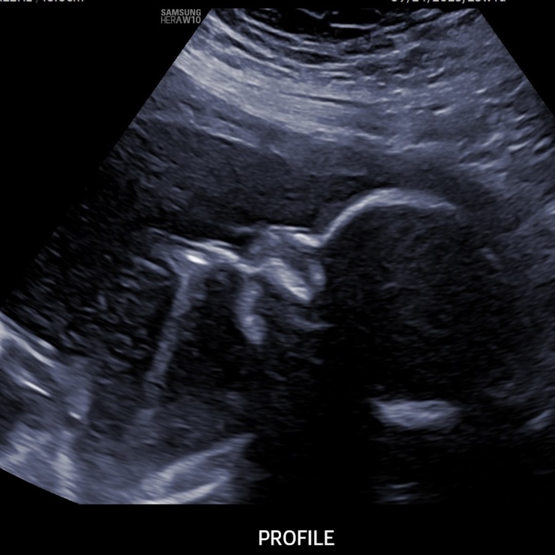 Photo shared by Shannon for their Babylist baby registry.
