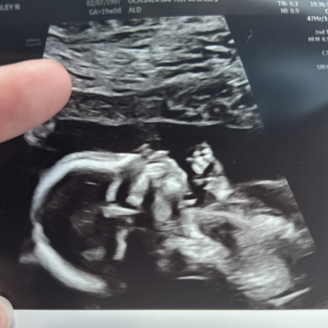 Photo shared by Ashley Nicole for their Babylist baby registry.