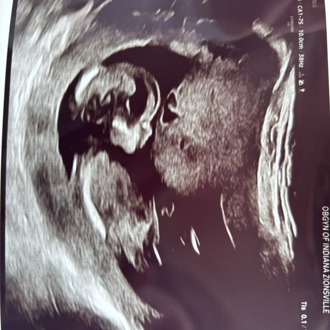 Photo shared by Lindsay for their Babylist baby registry.