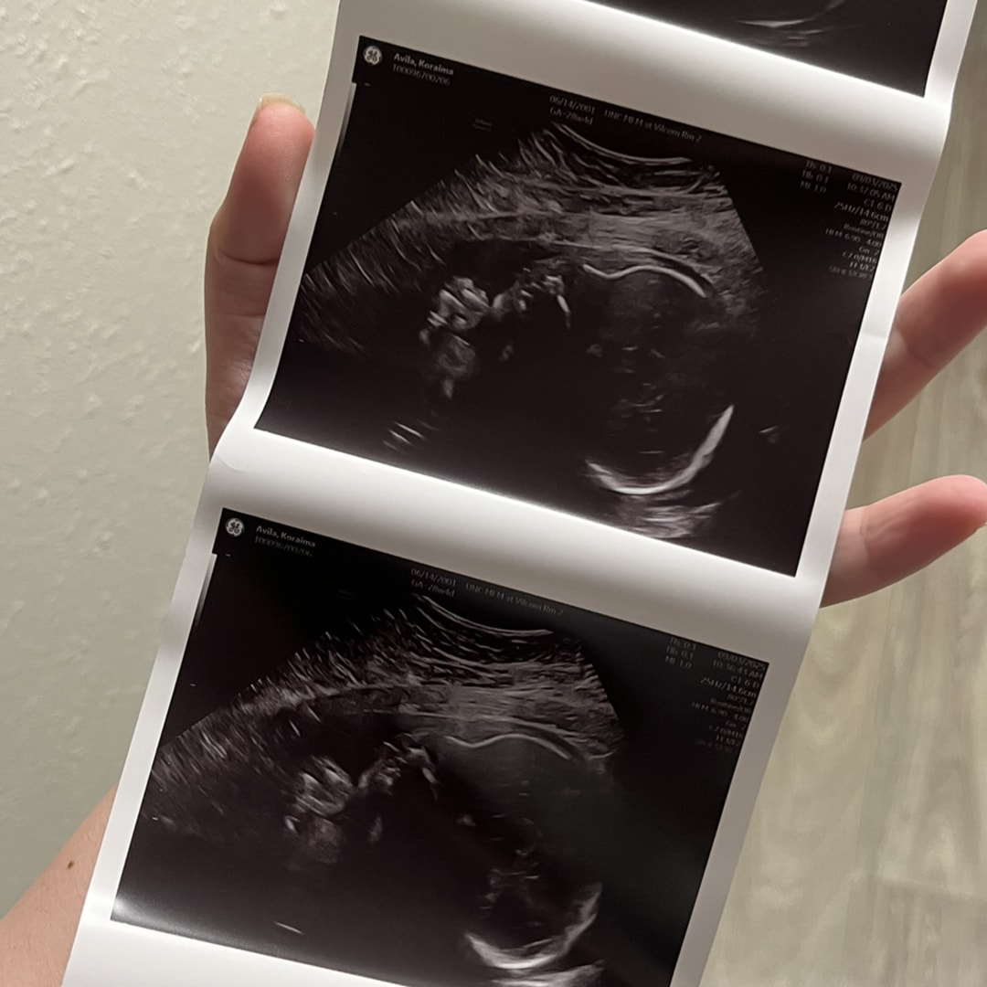 Photo shared by Koraima for their Babylist baby registry.