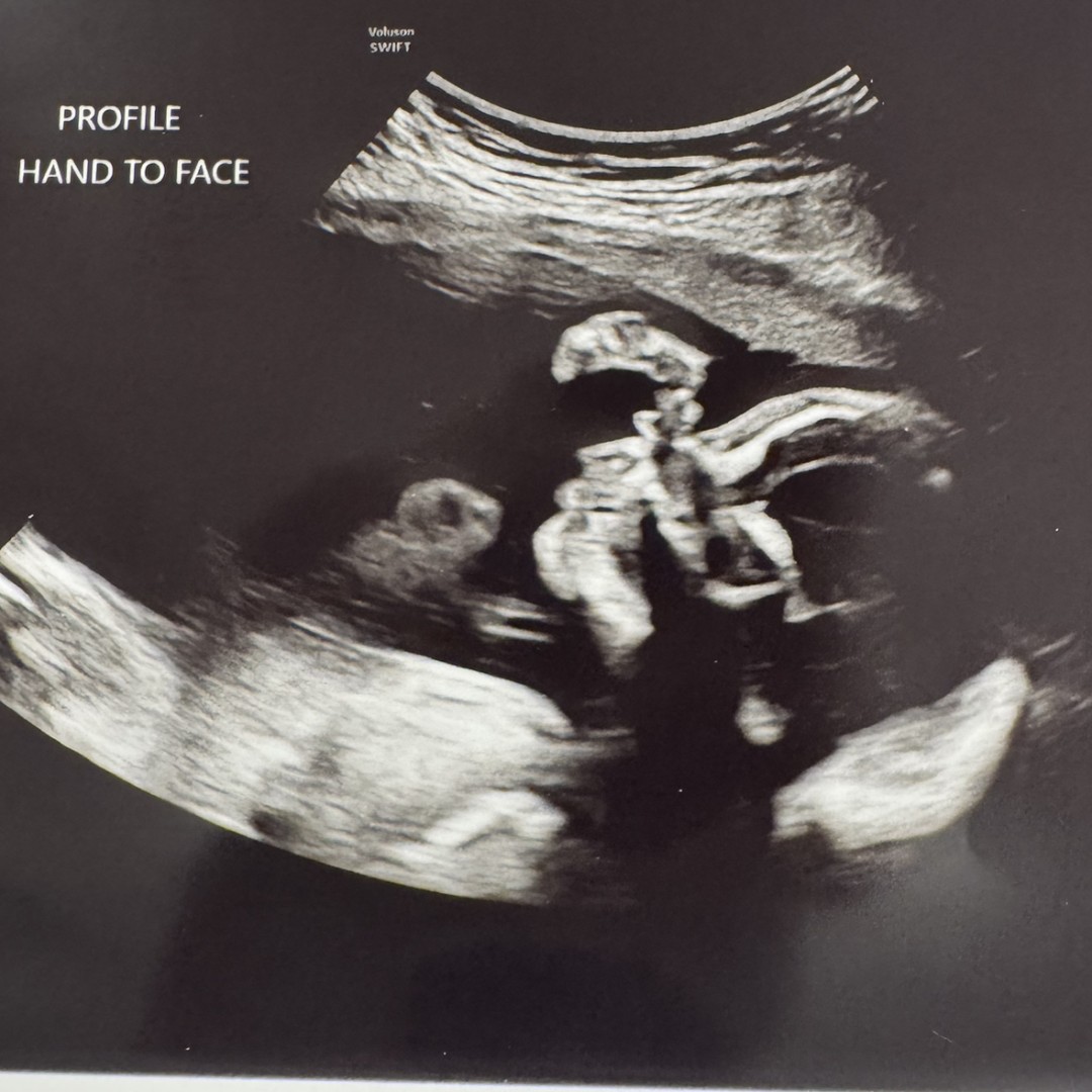 Photo shared by Monique for their Babylist baby registry.