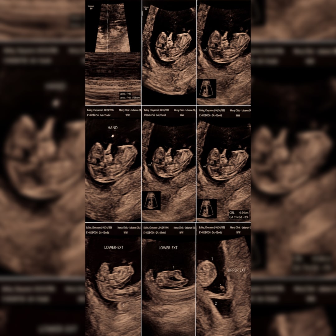 Photo shared by Cheyanne for their Babylist baby registry.