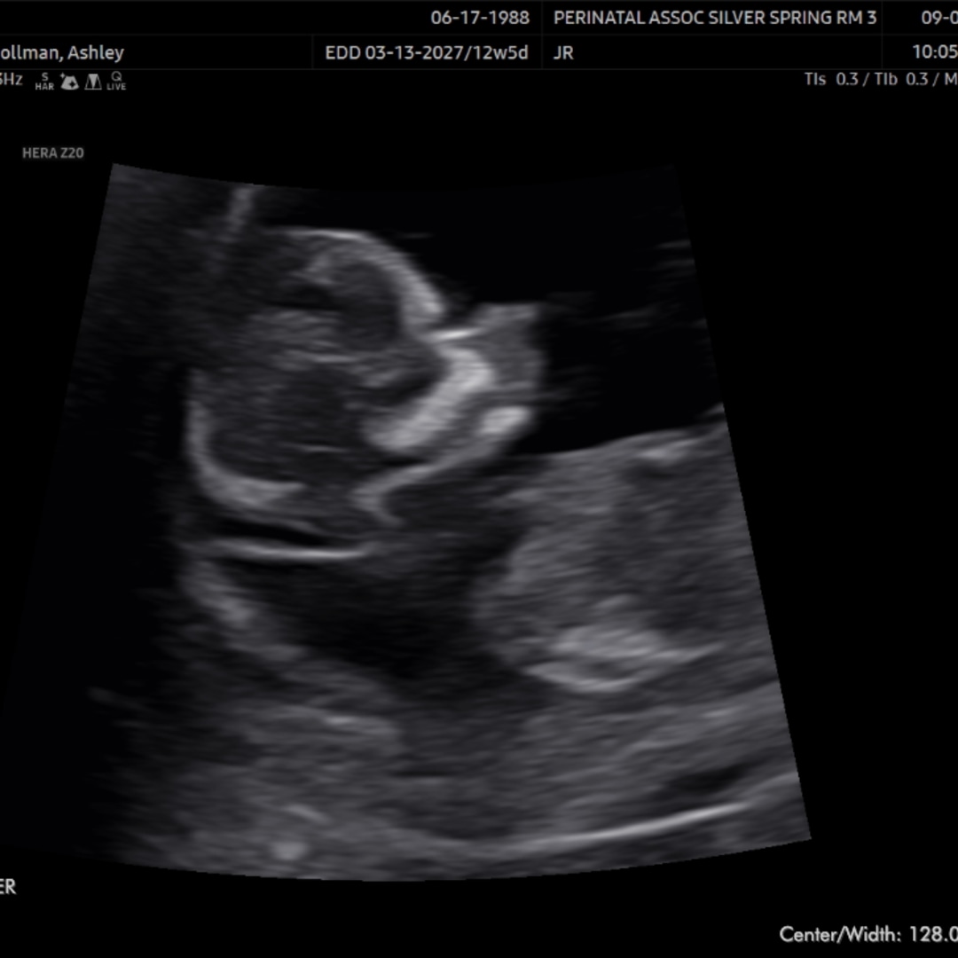 Photo shared by Ashley for their Babylist baby registry.