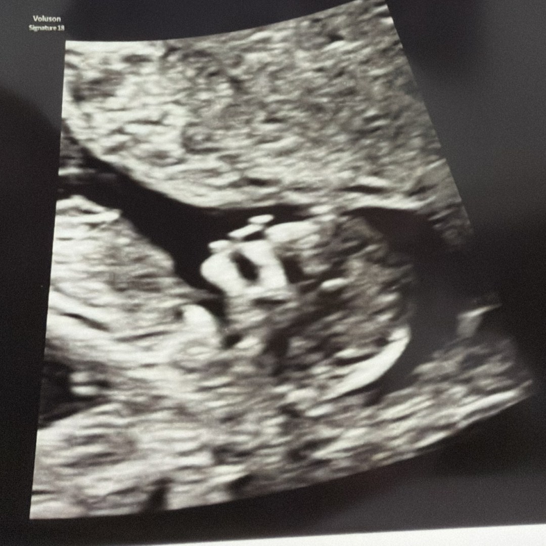 Photo shared by Miranda for their Babylist baby registry.