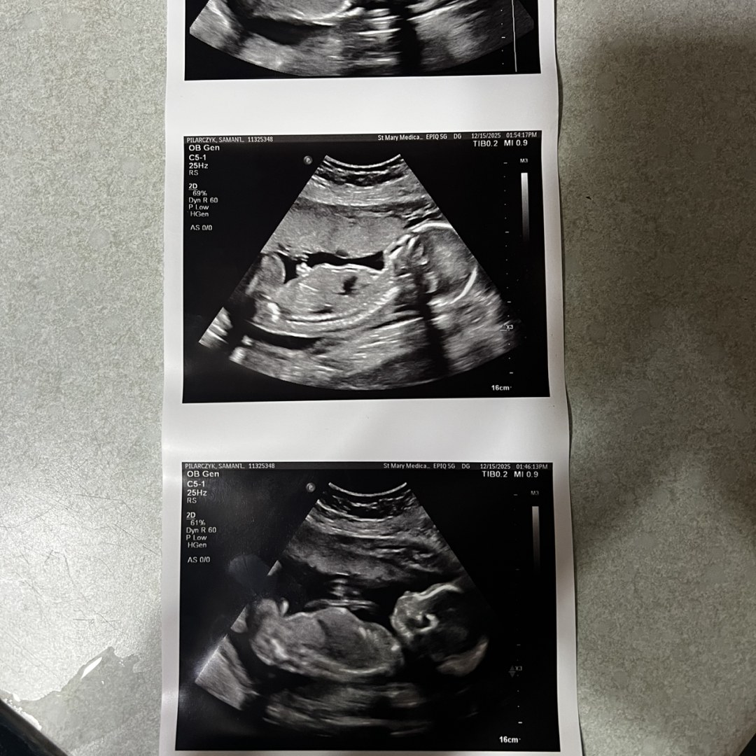 Photo shared by Samantha for their Babylist baby registry.