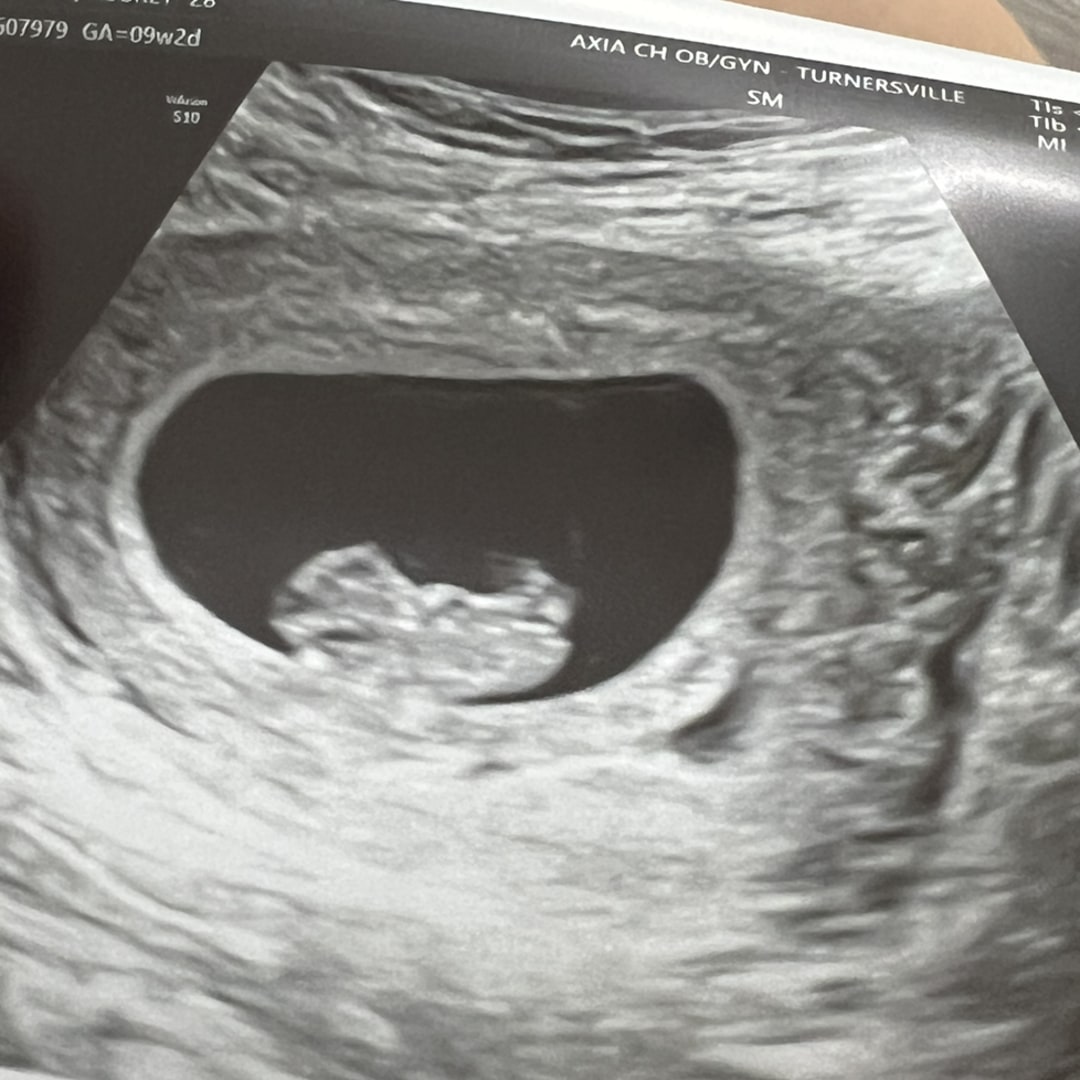 Photo shared by Aubrey for their Babylist baby registry.