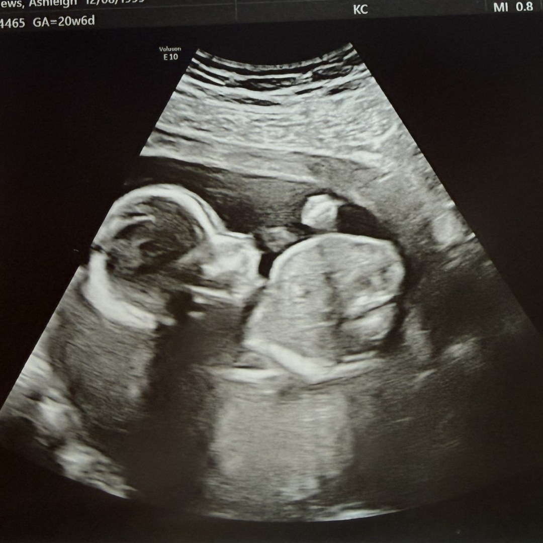 Photo shared by Ashleigh for their Babylist baby registry.