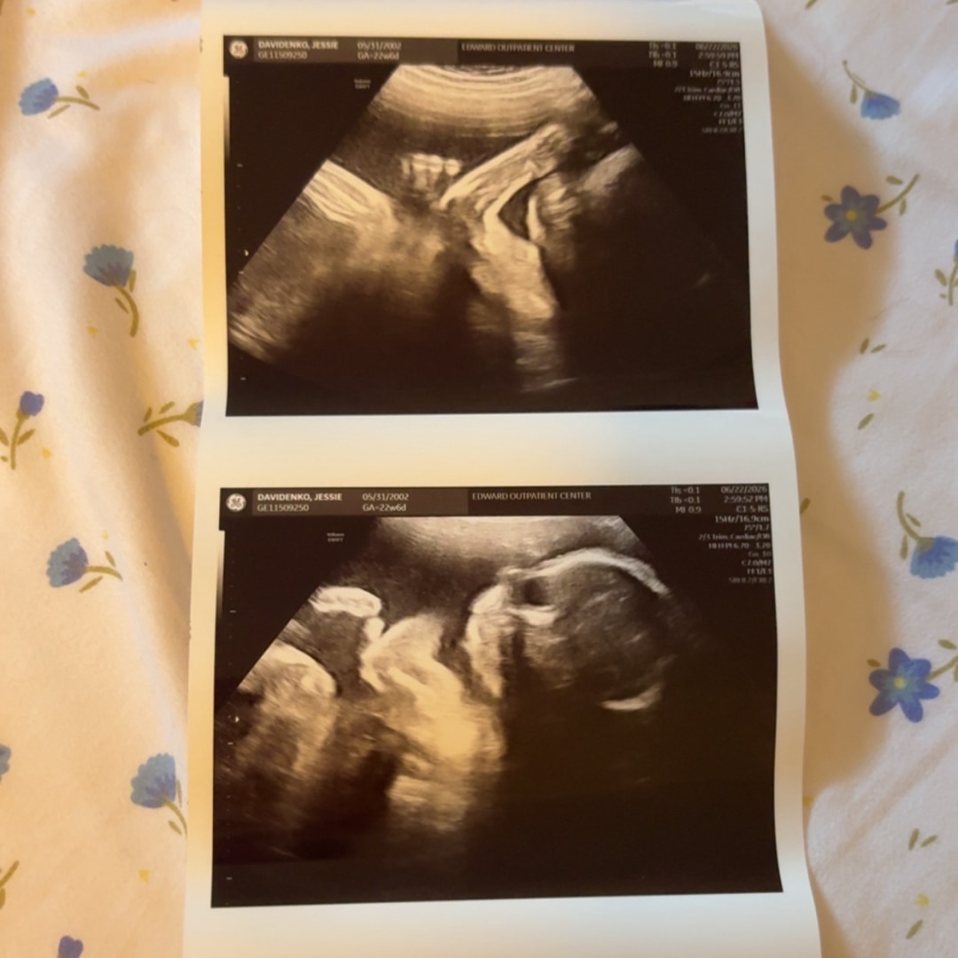 Photo shared by Jessie for their Babylist baby registry.
