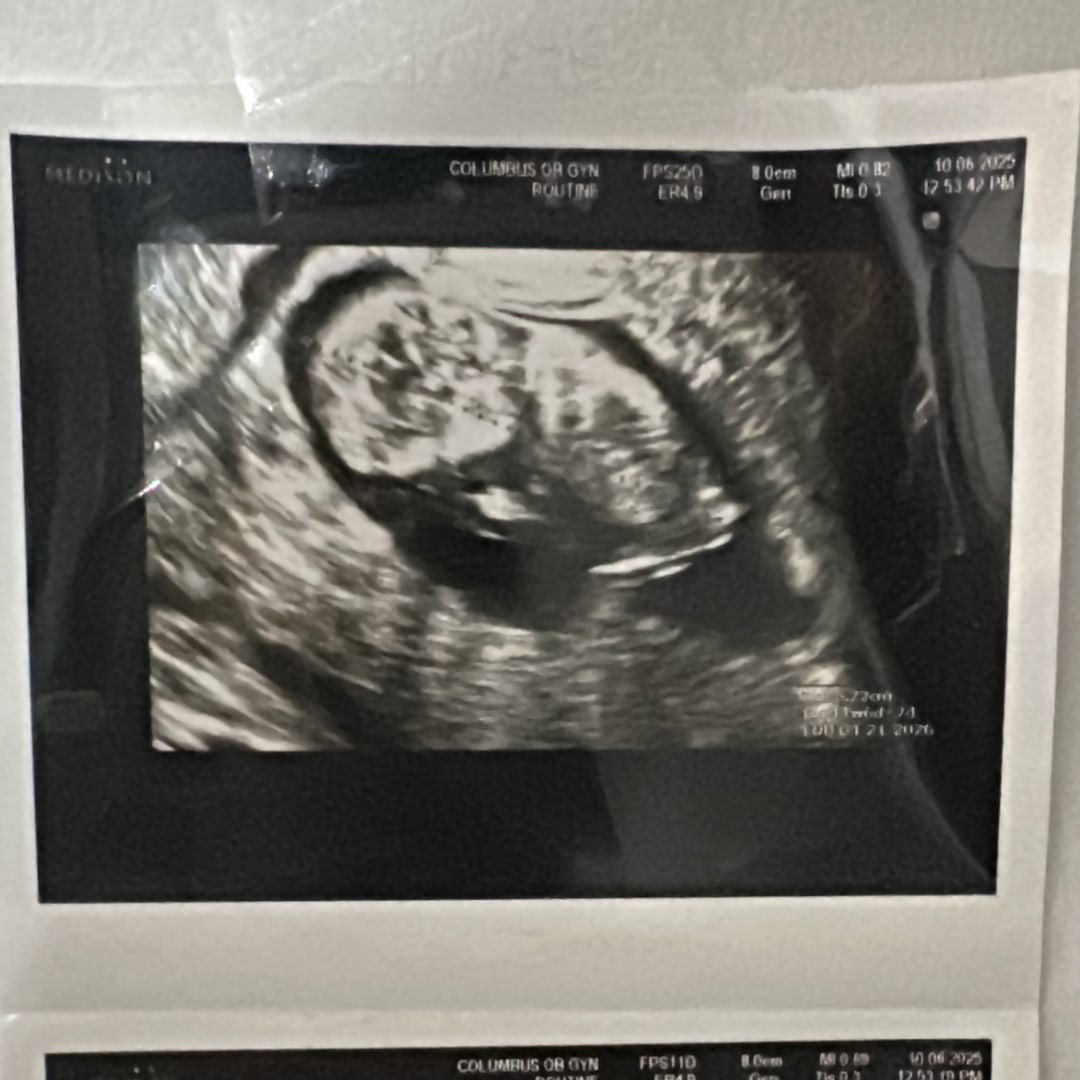 Photo shared by Isabella for their Babylist baby registry.