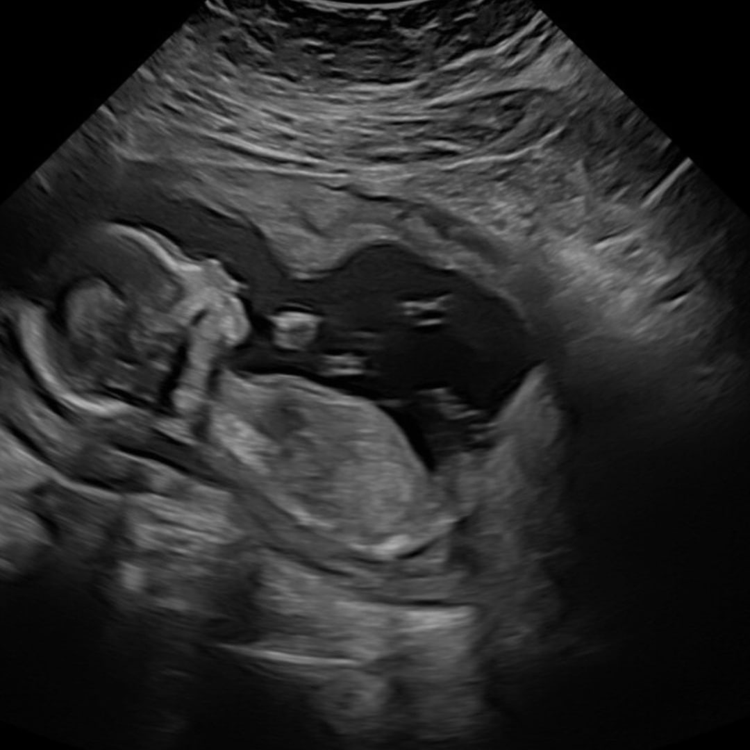 Photo shared by Yesenia for their Babylist baby registry.