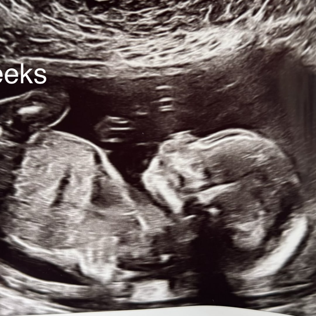 Photo shared by Elizabeth for their Babylist baby registry.