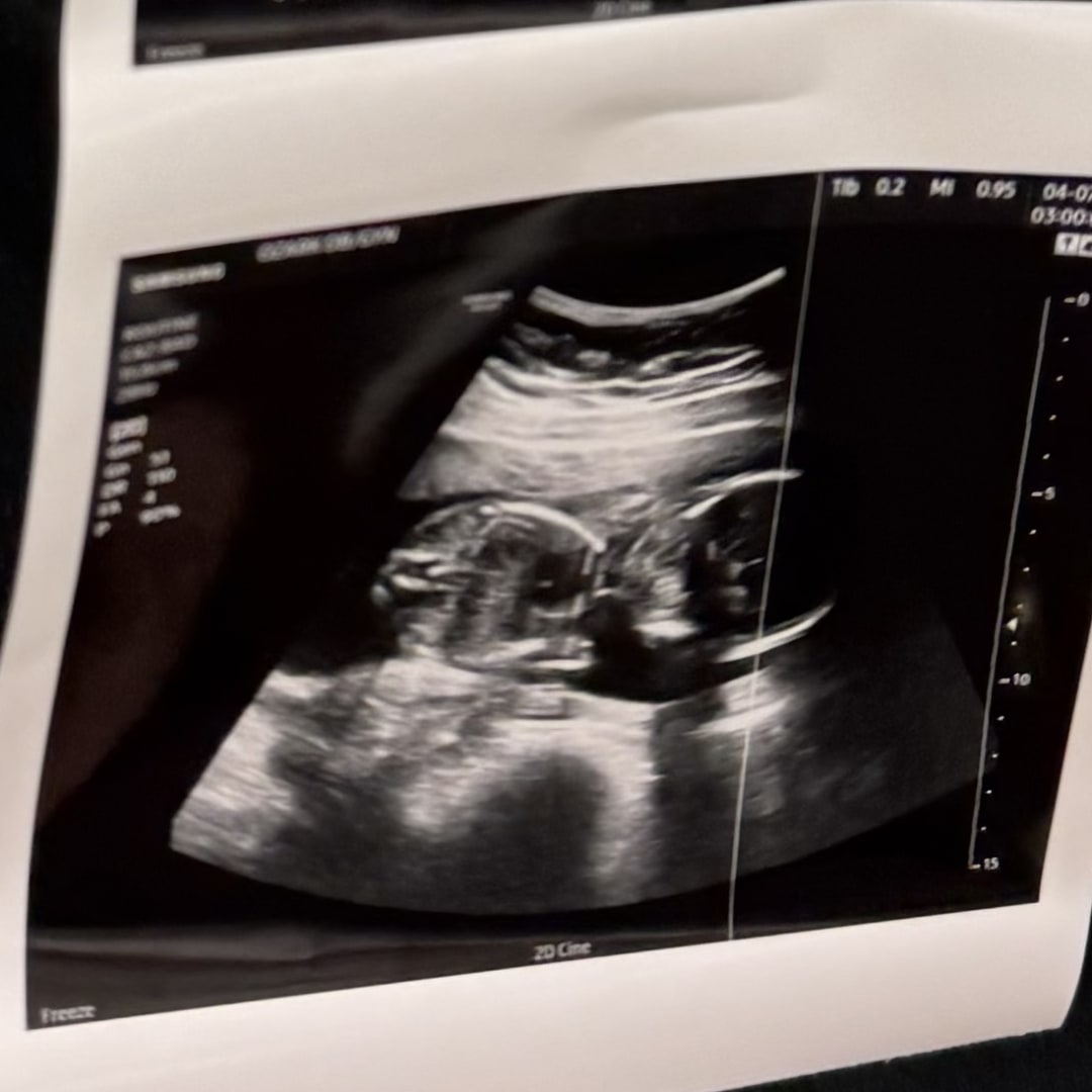 Photo shared by Carly for their Babylist baby registry.