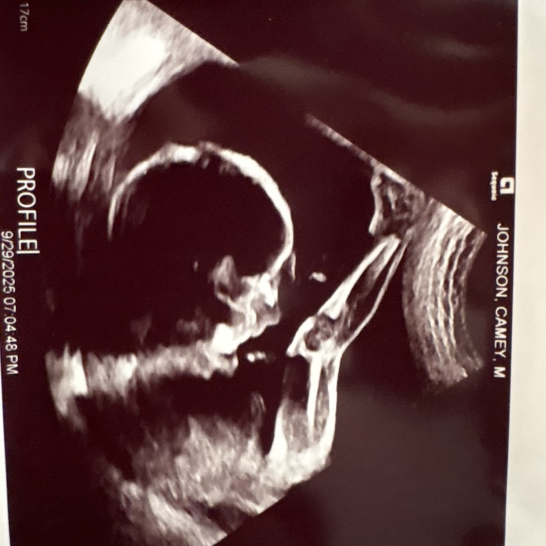 Photo shared by Camey for their Babylist baby registry.