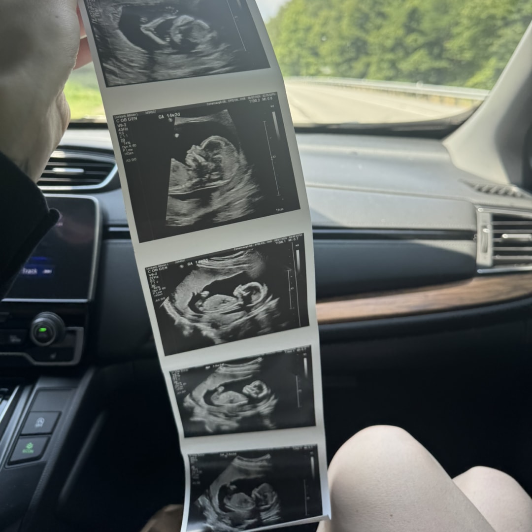 Photo shared by Allison for their Babylist baby registry.