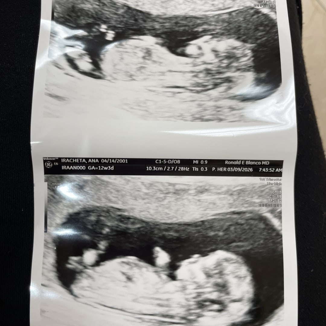Photo shared by Ana for their Babylist baby registry.