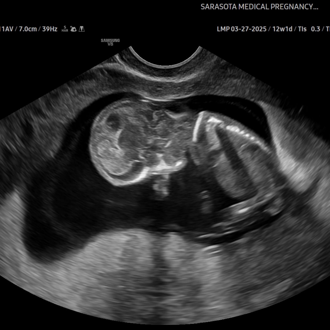 Photo shared by Elianis for their Babylist baby registry.