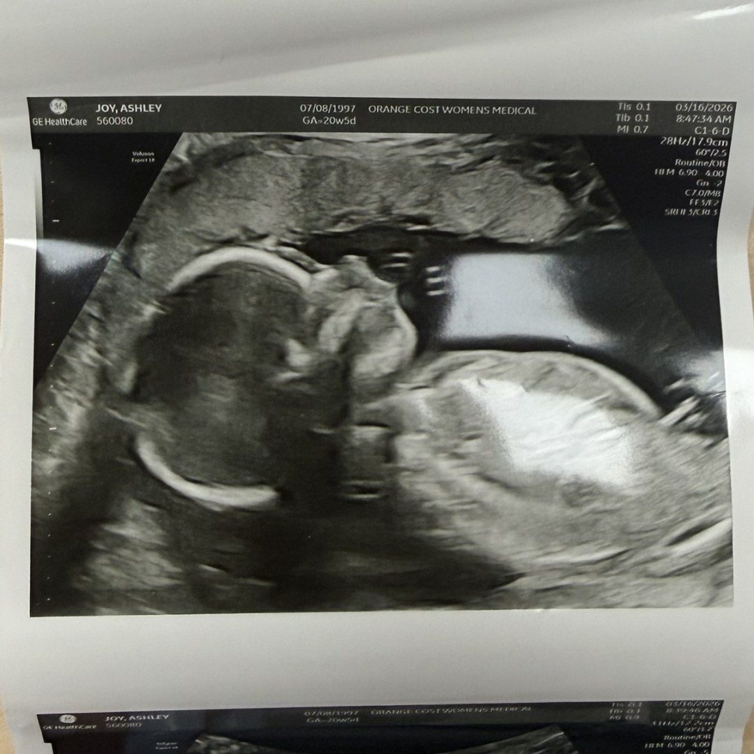 Photo shared by Ashley for their Babylist baby registry.