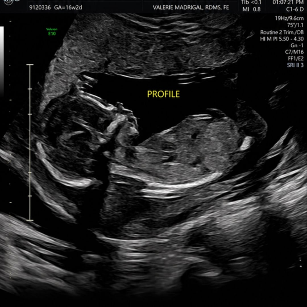 Photo shared by Genesis for their Babylist baby registry.