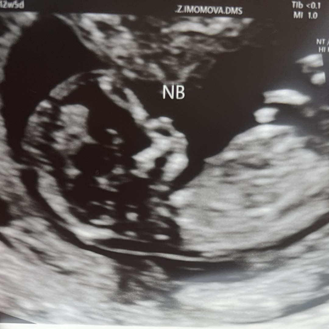 Photo shared by Kiara for their Babylist baby registry.