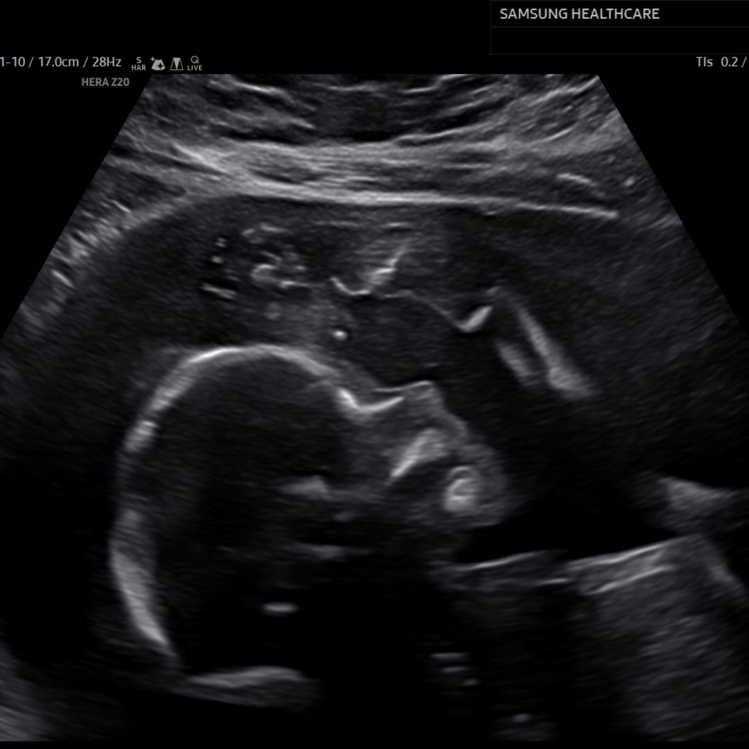 Photo shared by Arylenna for their Babylist baby registry.