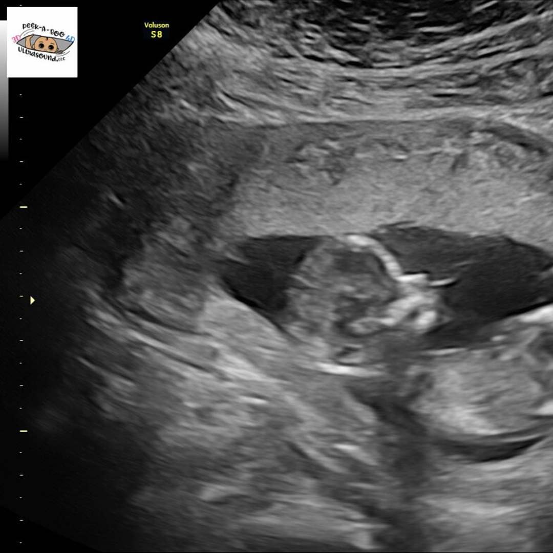 Photo shared by Gianna for their Babylist baby registry.