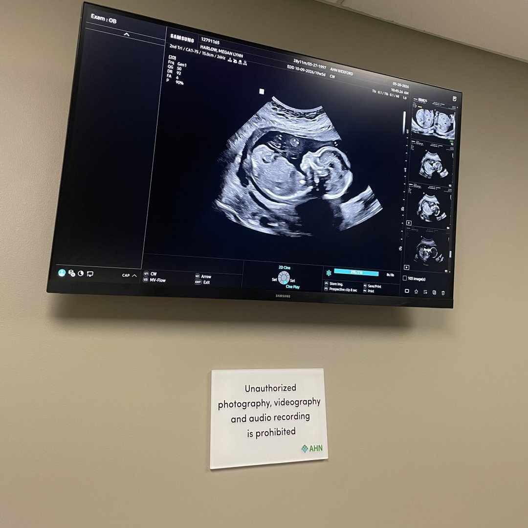 Photo shared by Megan for their Babylist baby registry.