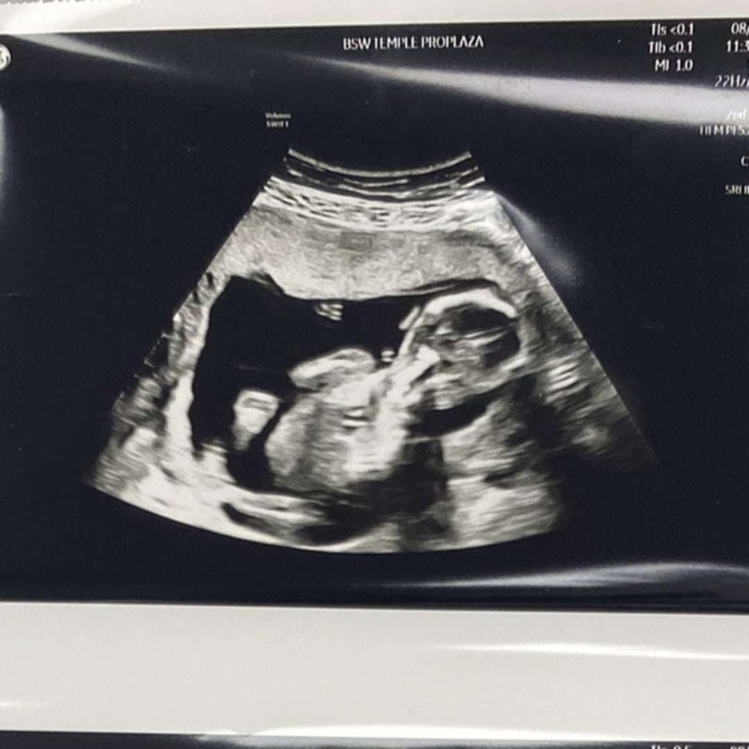 Photo shared by Jessica for their Babylist baby registry.