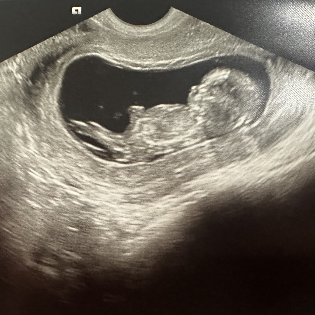 Photo shared by Christina for their Babylist baby registry.