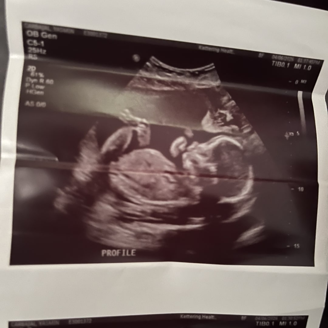 Photo shared by Yasmin for their Babylist baby registry.