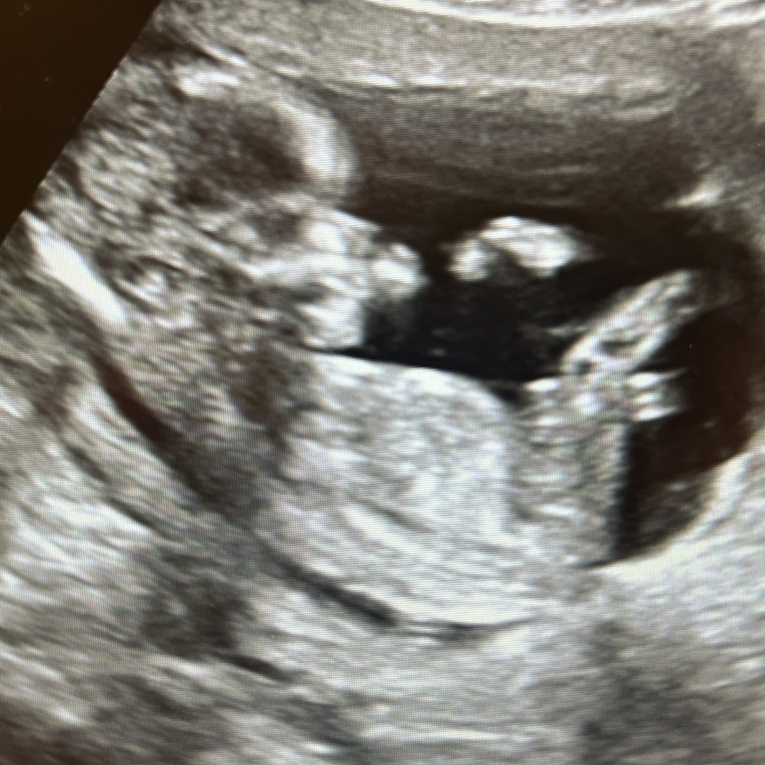 Photo shared by Alison for their Babylist baby registry.