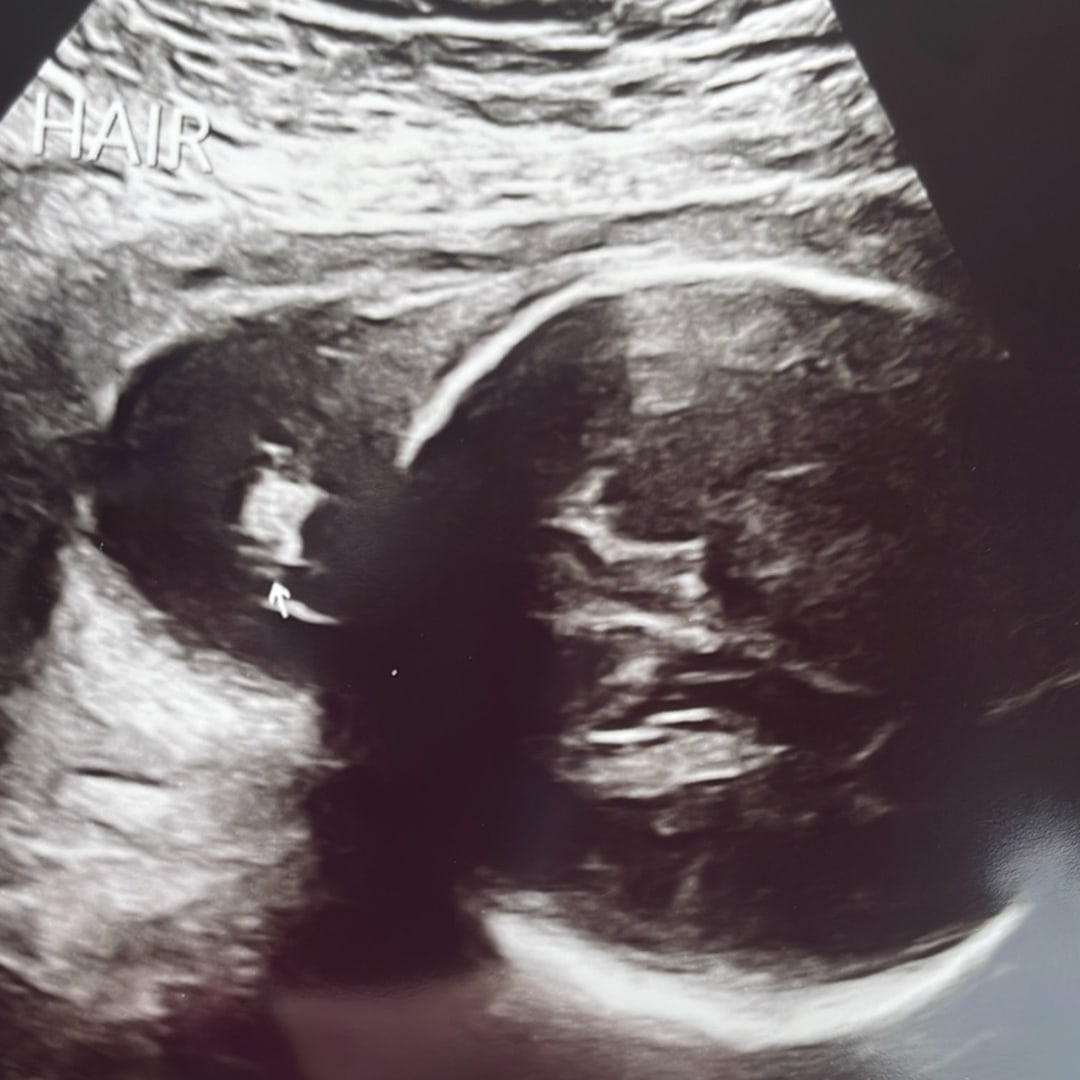 Photo shared by Hope for their Babylist baby registry.