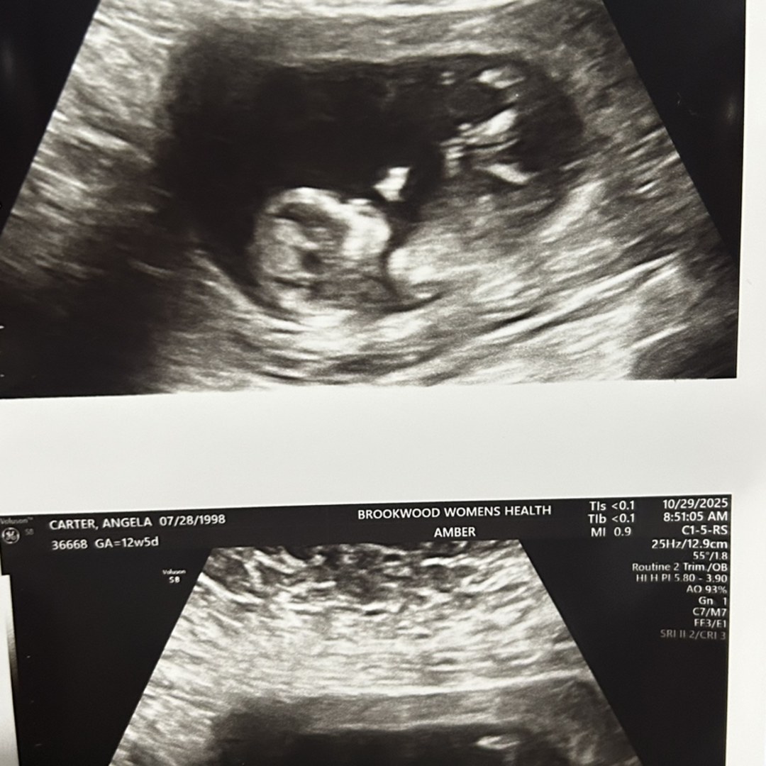 Photo shared by Angela for their Babylist baby registry.