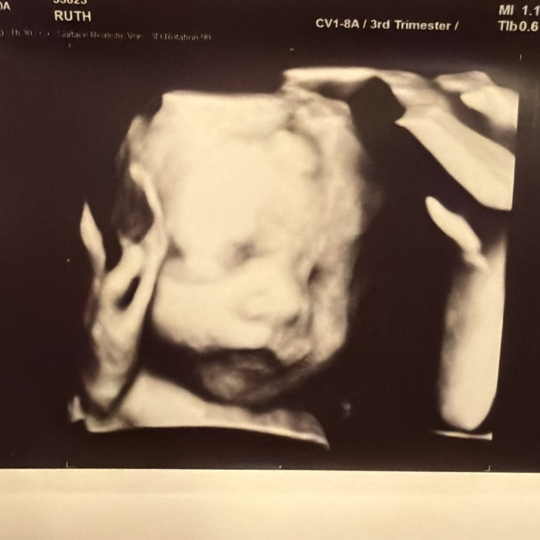Photo shared by Ruth for their Babylist baby registry.