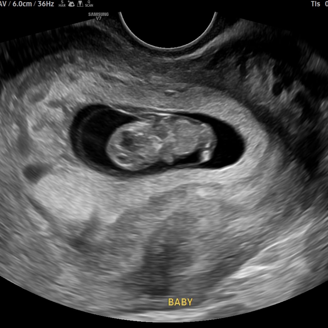 Photo shared by Amber for their Babylist baby registry.