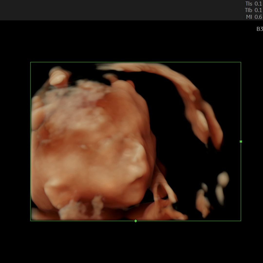 Photo shared by Angela for their Babylist baby registry.