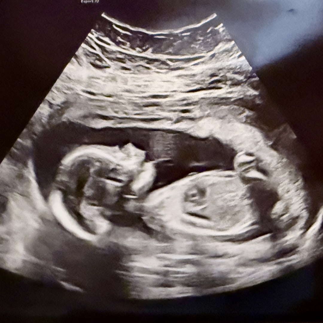 Photo shared by Jacquelyn for their Babylist baby registry.