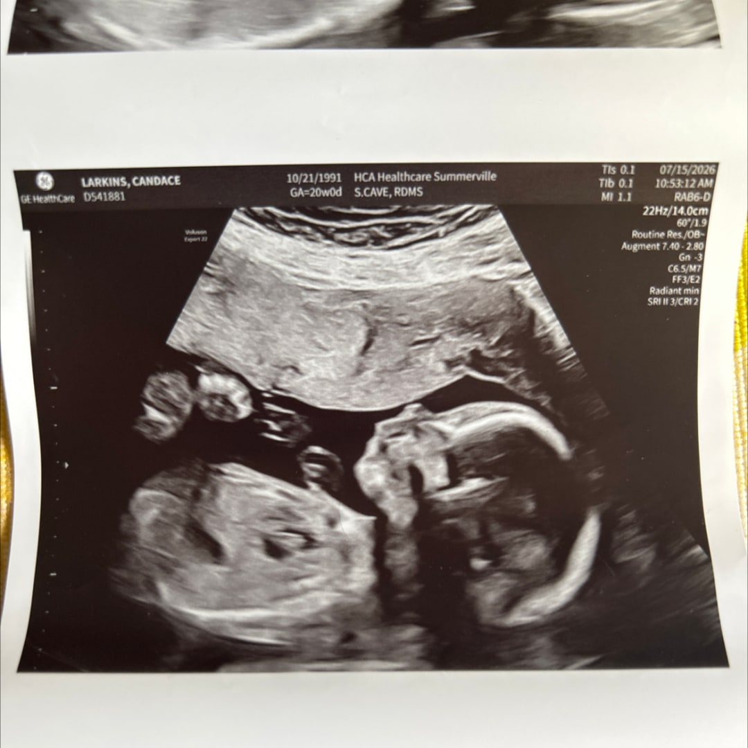 Photo shared by Candace for their Babylist baby registry.
