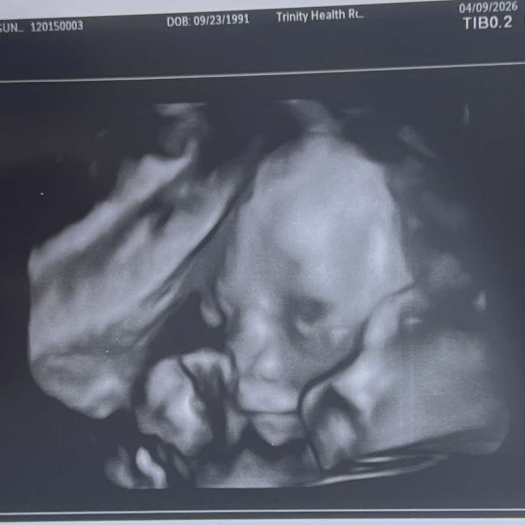 Photo shared by Madisun for their Babylist baby registry.