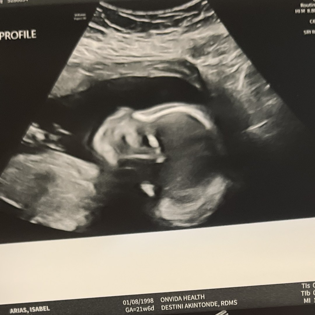 Photo shared by Isabel for their Babylist baby registry.