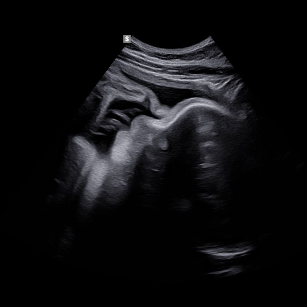 Photo shared by Brianna for their Babylist baby registry.