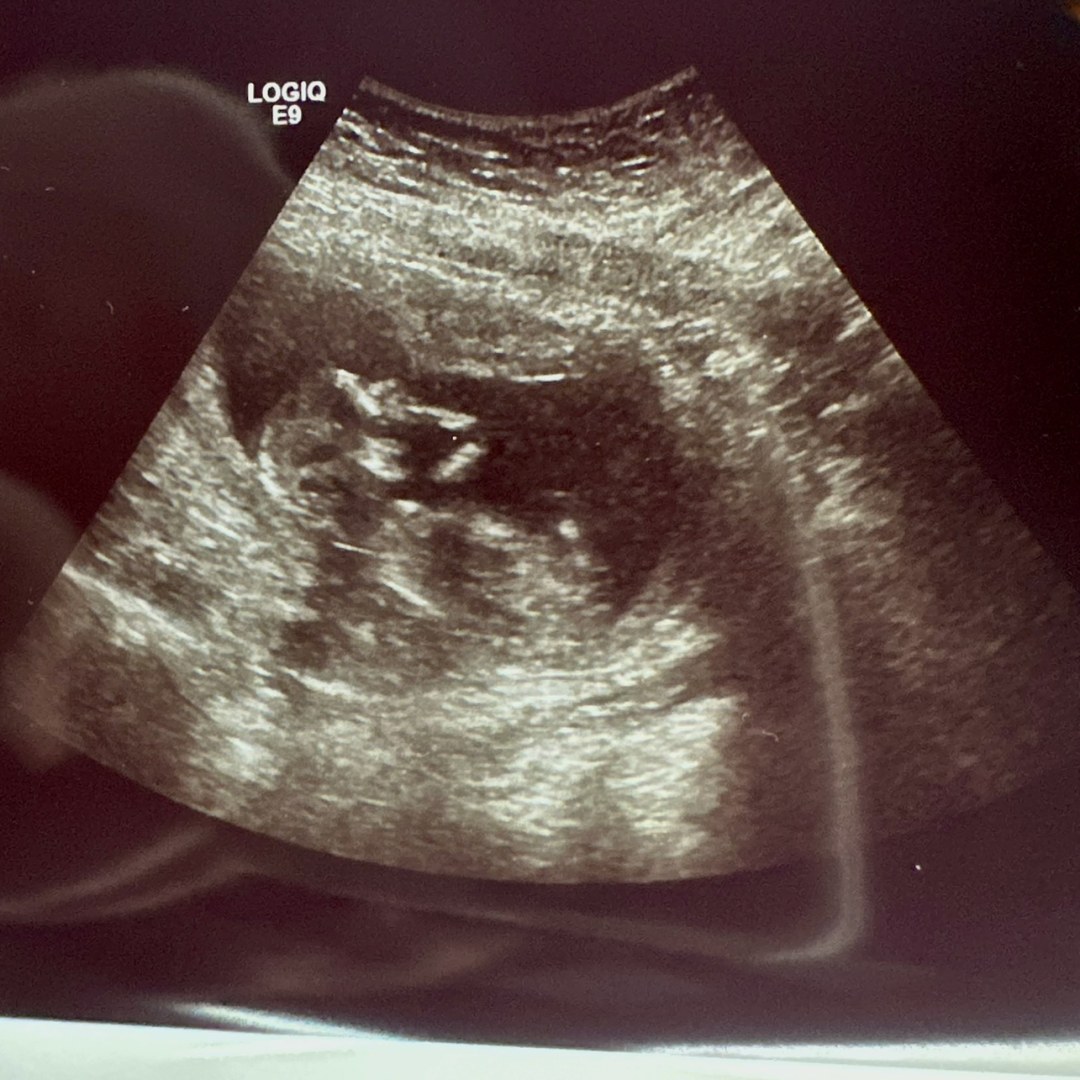 Photo shared by Breanna for their Babylist baby registry.