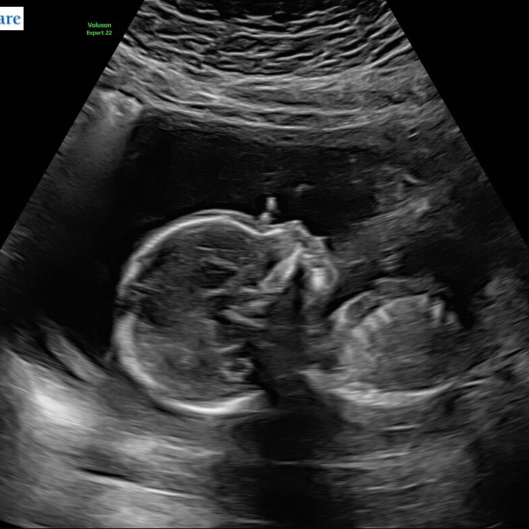 Photo shared by Emily for their Babylist baby registry.