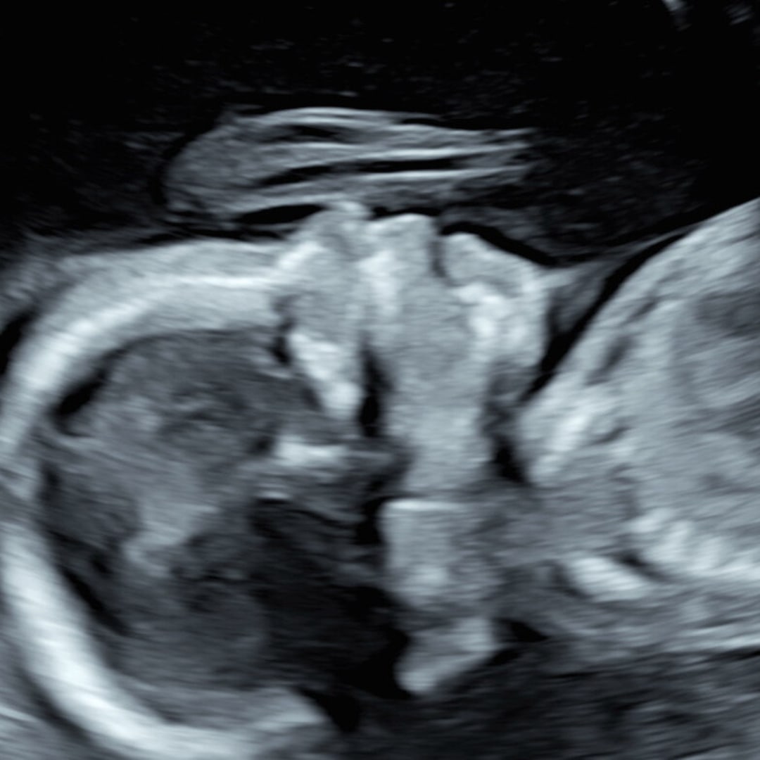 Photo shared by Jaylynn for their Babylist baby registry.