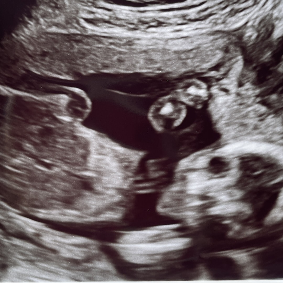 Photo shared by Anna for their Babylist baby registry.