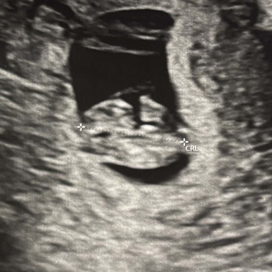 Photo shared by Rachel for their Babylist baby registry.