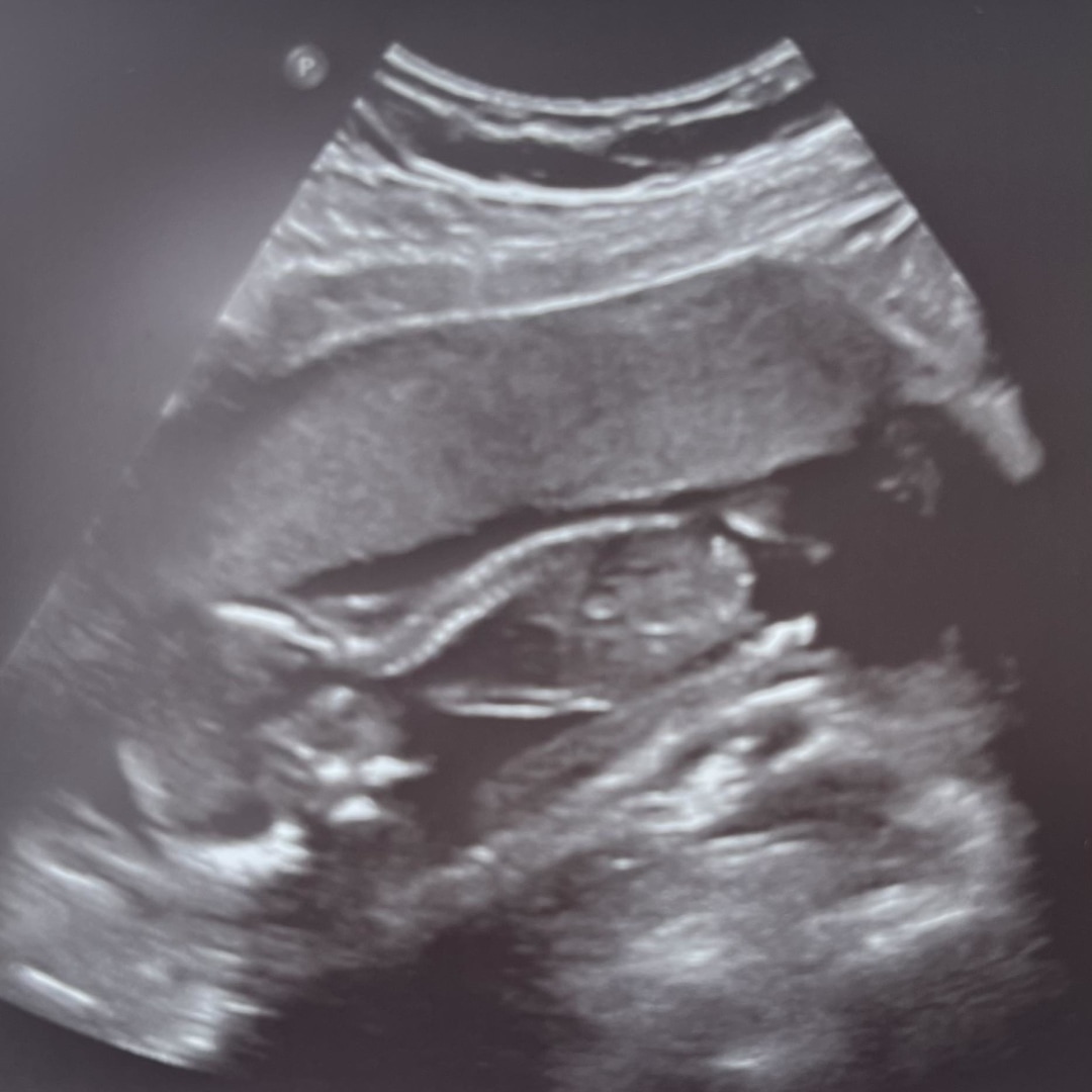 Photo shared by Jessica for their Babylist baby registry.
