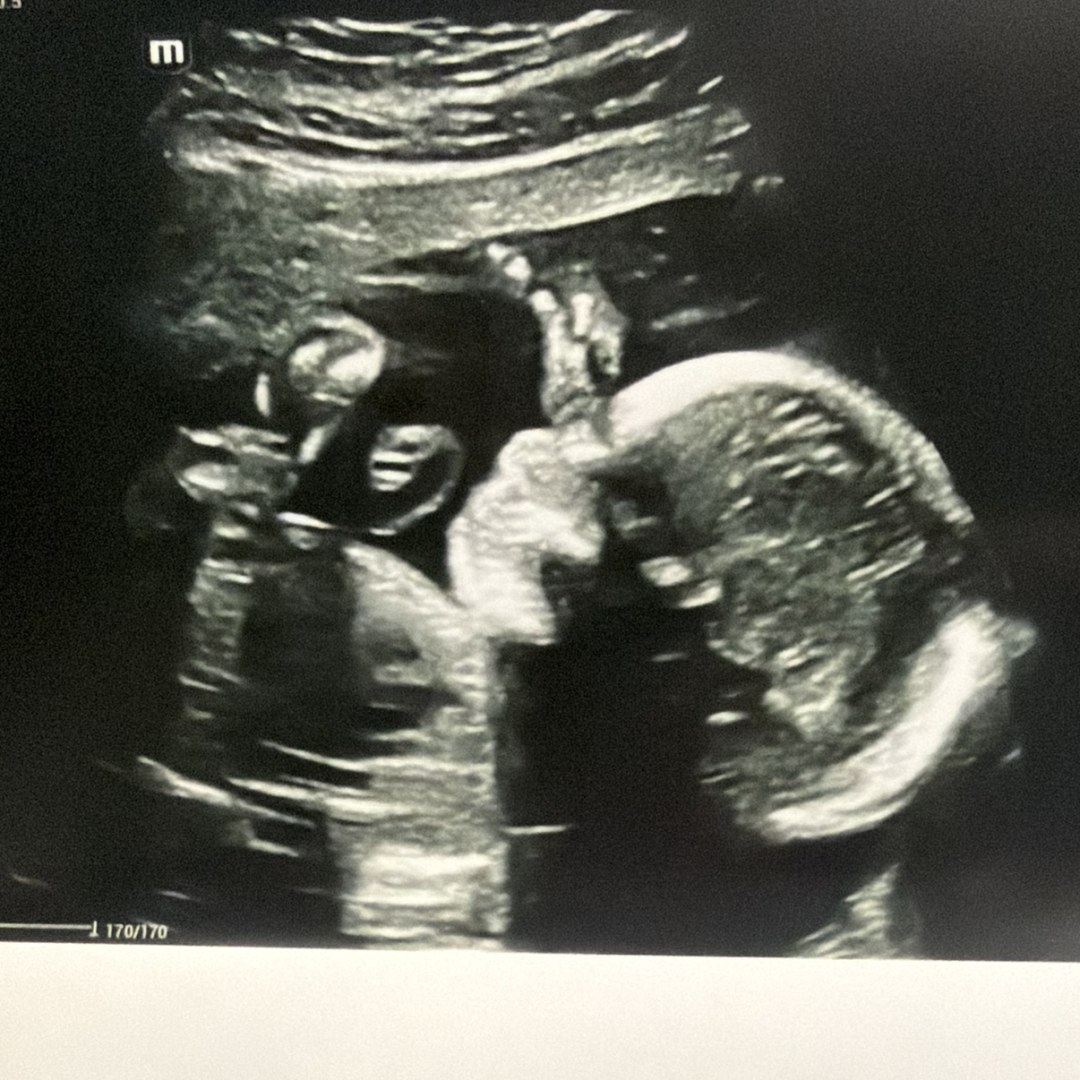 Photo shared by Aliyah for their Babylist baby registry.