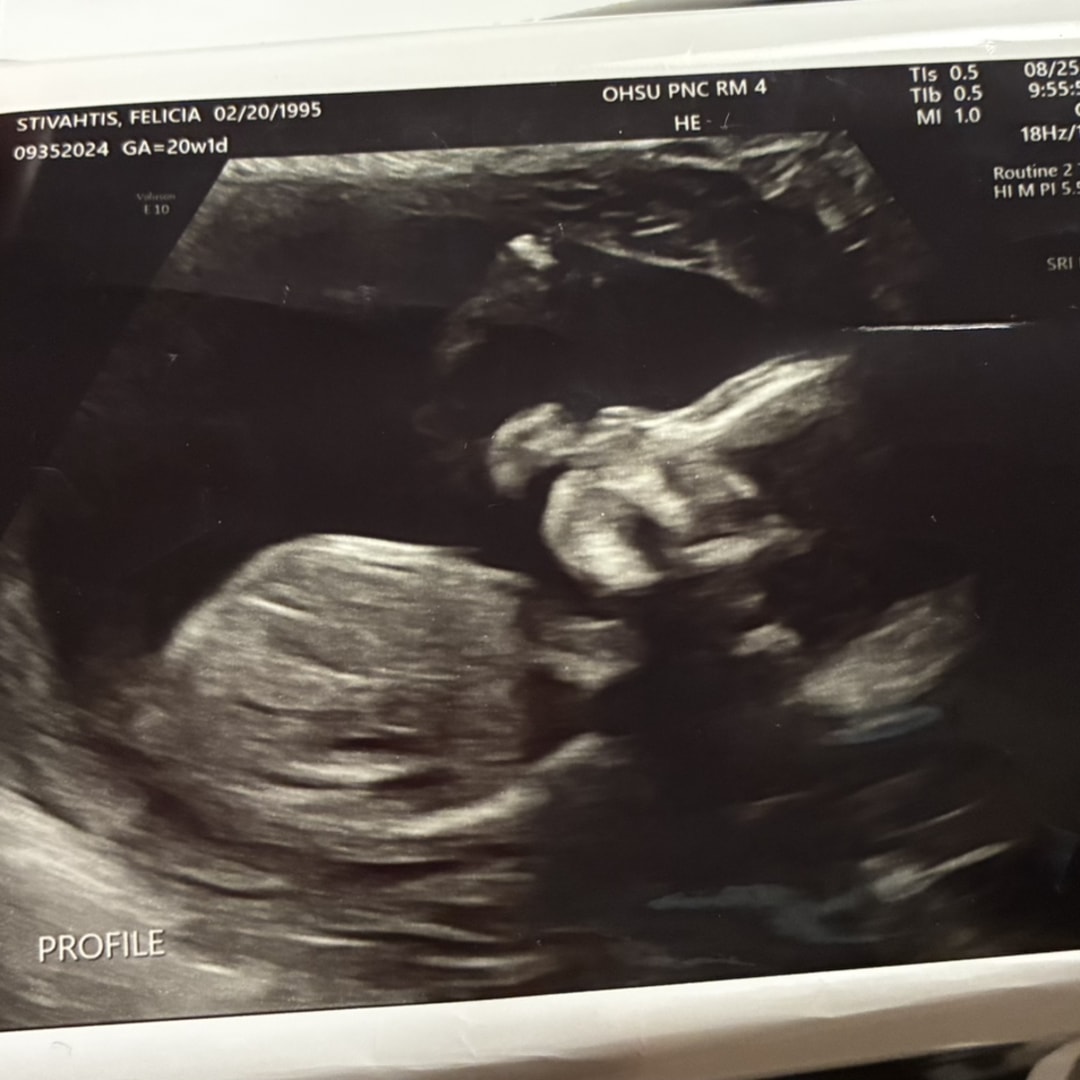 Photo shared by Felicia for their Babylist baby registry.